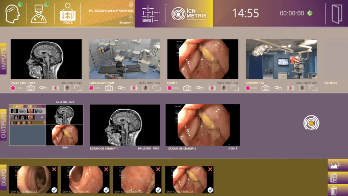 Visualiser notre logiciel SMS de gestion vidéo destiné au bloc opératoire conçu par ICN METRIS