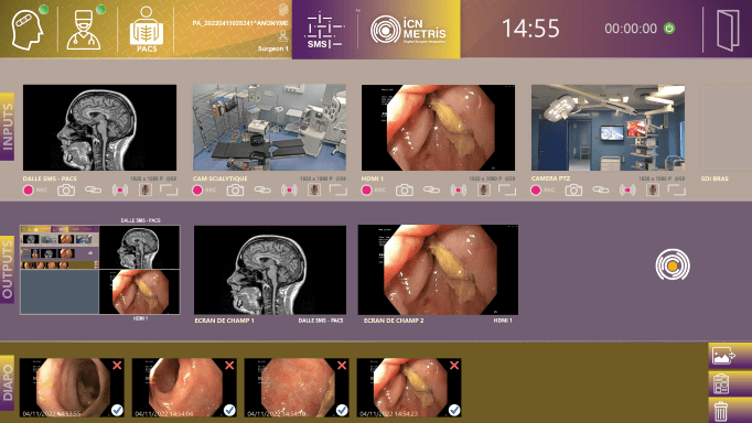 Vea nuestro software de gestión de vídeo SMS para quirófanos diseñado por ICN METRIS