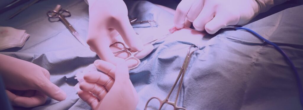 Article blog Lampes scialytiques chirurgiens