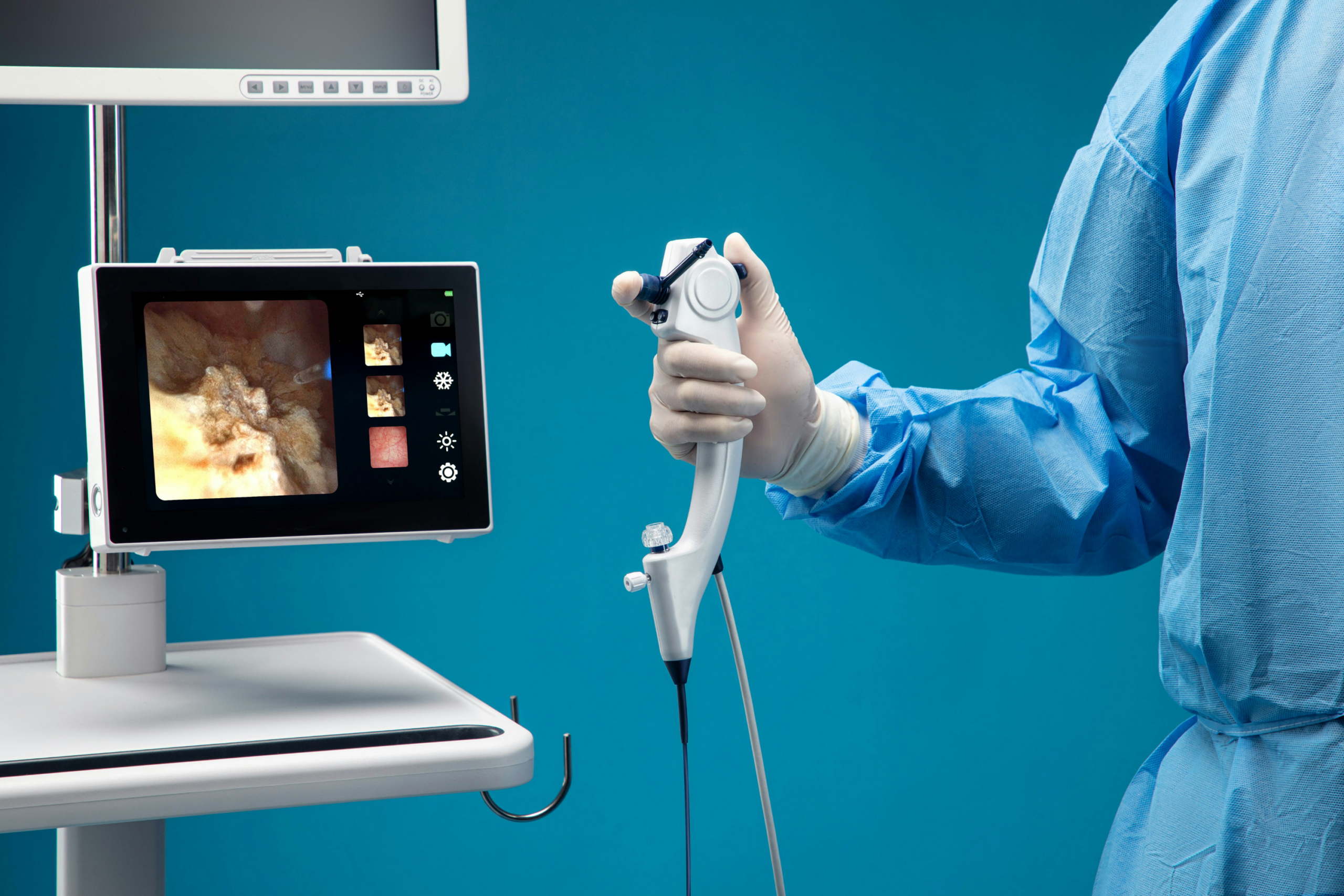 Chirurgien tenant une caméra endoscopique avec visualisation sur un écran de vidéo management.